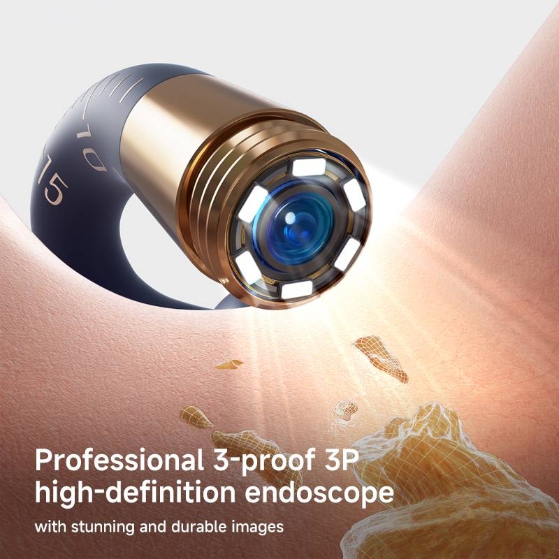 گوش پاک کن هوشمند مدل Bebird I35R