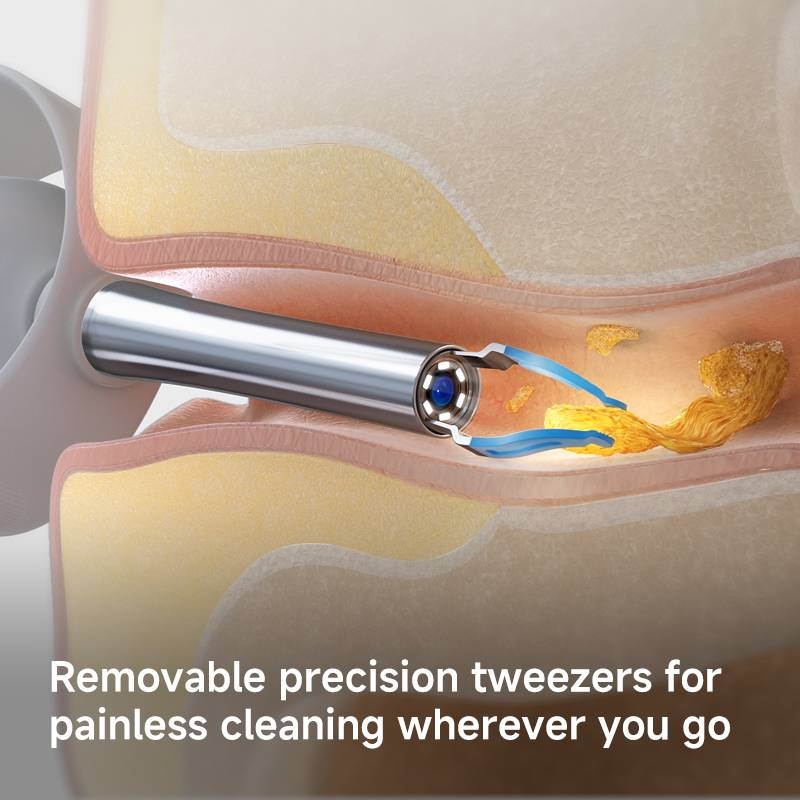 گوش پاک کن هوشمند مدل Bebird I35R